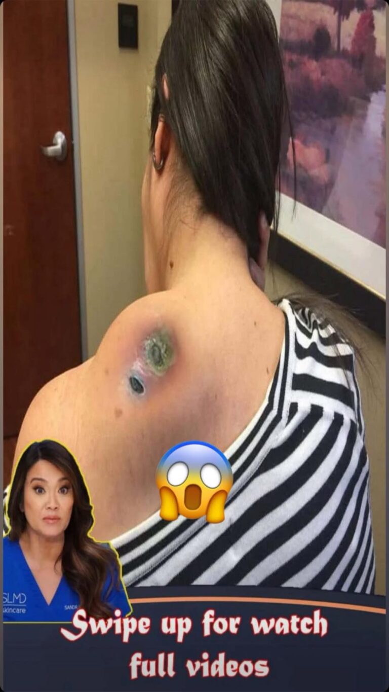 The Impact of Short Sleep: 6 Effects You Should Know.