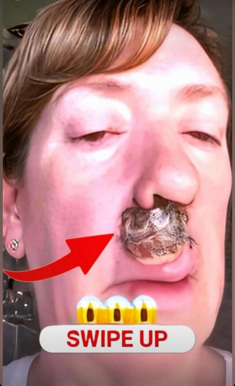 The Body’s Interconnected System: Causes and Prevention.