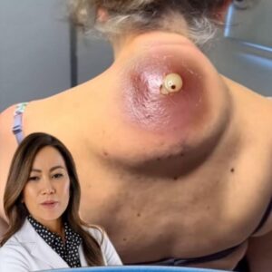 How Wearable Technology is Changing Our Health.