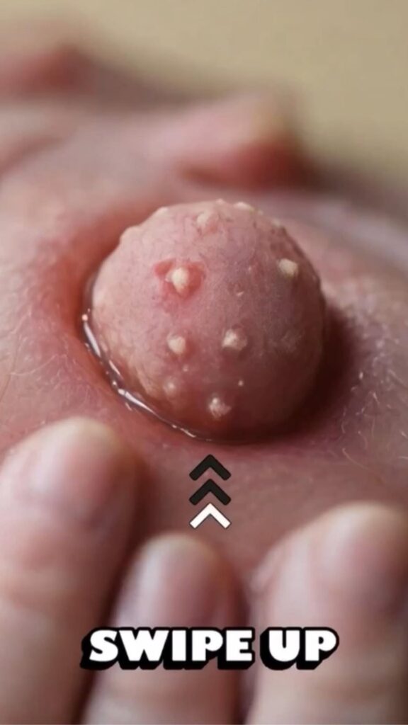 If this is happening on your body!