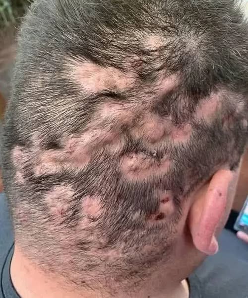 Early warning signs: signs that your health is at risk.