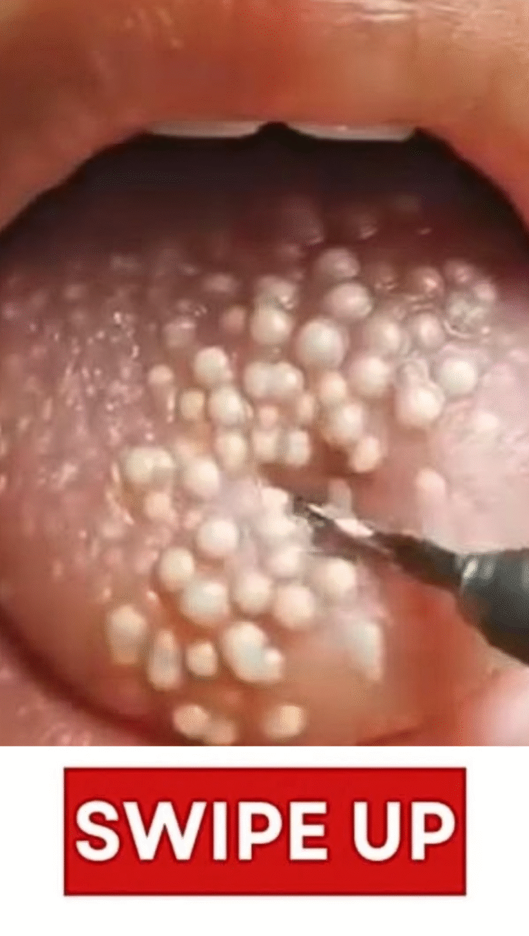 These are the consequences of eating …See more