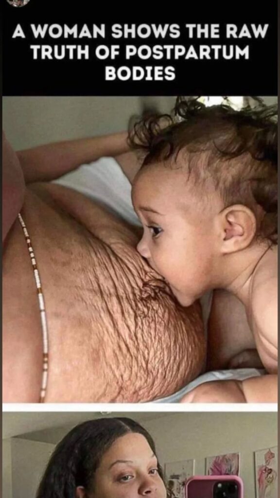 Postpartum Changes, Celebrity Moms Embracing Their Bodies