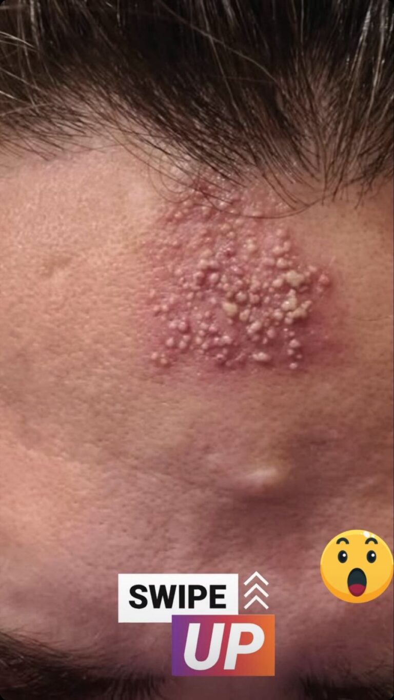 See These are the consequences of sleeping with…