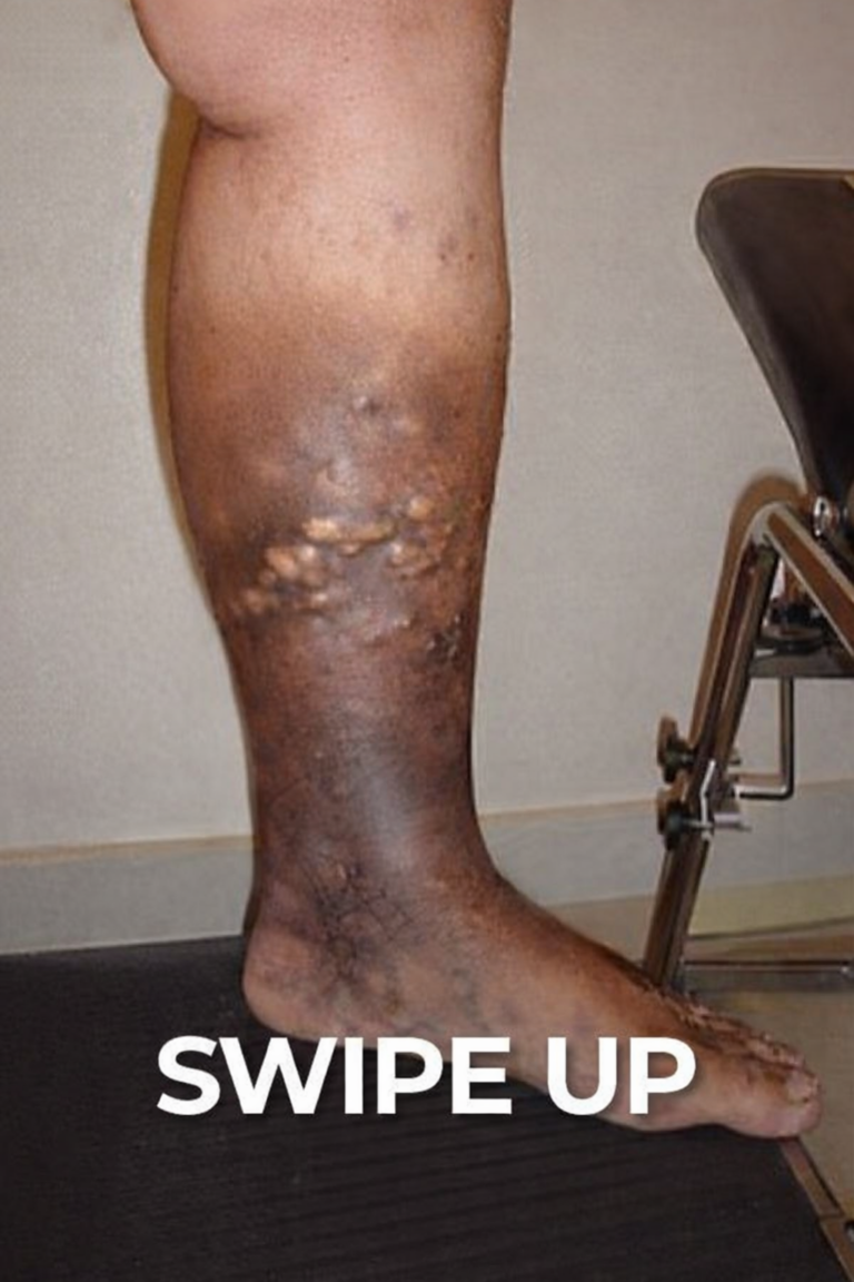 These are the first symptoms of cr…