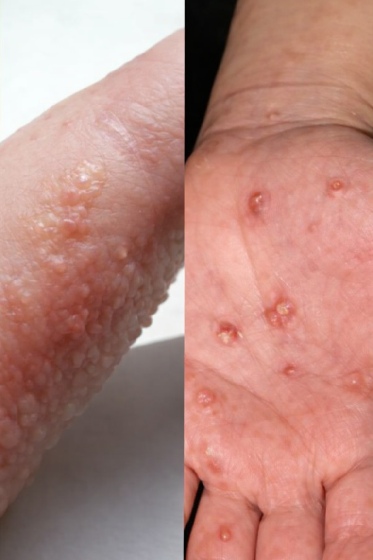 lf you have these sings on the body see a doctor immediaeIy