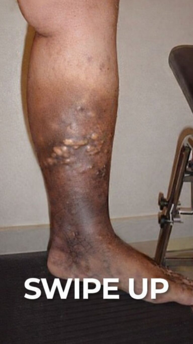 These are the first symptoms of cr…
